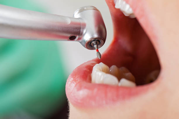 Best Pediatric Emergency Dentist in Ely, IA